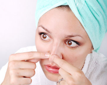 Blackheads-On-Nose