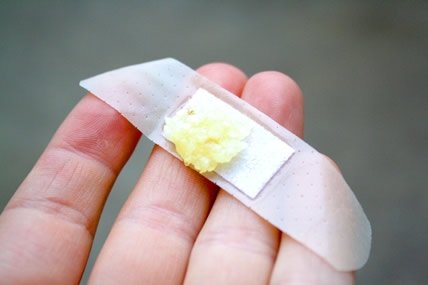 cesnak ako liek (4)