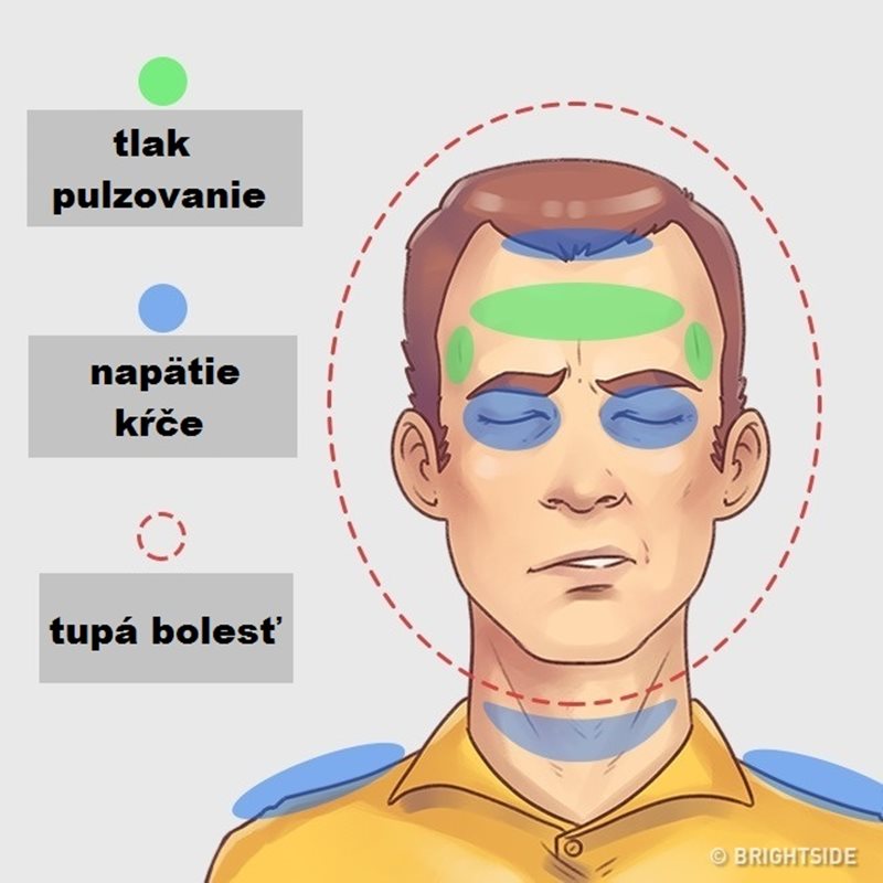 hlava001